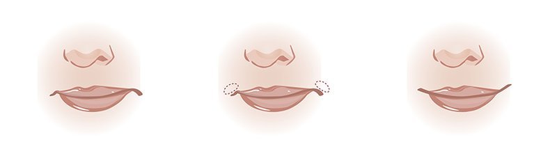 formy gub v zavisimosti ot tekhniki uvelicheniya167 Форми губ в залежності від техніки збільшення