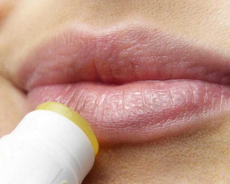 93288fd6d3c471512be2e0e20b2246e9 Тріщини на губах — причини і лікування в домашніх умовах