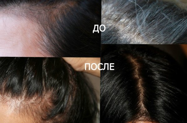 cbc897f59f50061d18e2f898020ff47b Басма для волосся. Відгуки, фото до і після, користь, шкоду, де купити, відтінки, як фарбувати у чорний колір